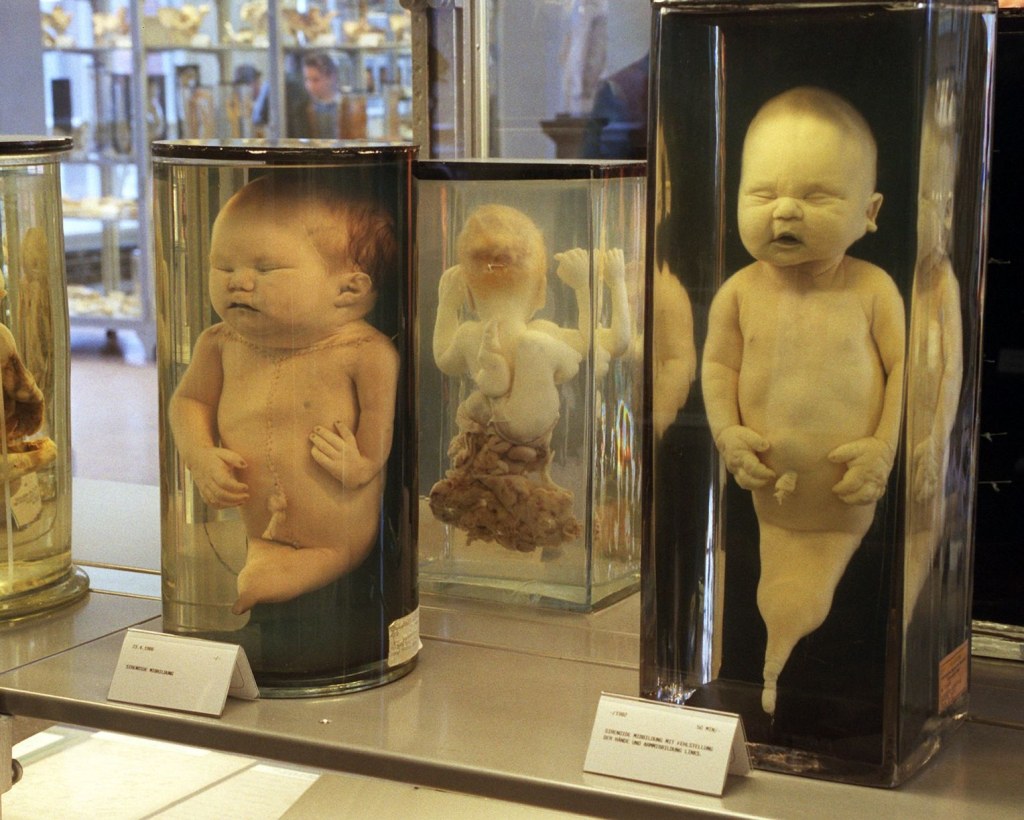 Picture of: Berlin’s Cabinet of Horrors: World’s First Pathology Museum
